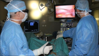Operace pomocí 3D laparoskopické sestavy (přístroj vpravo). Vlevo je nový peroperační ultrazvuk.