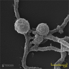 Mikrofotografie - Borrelia spp