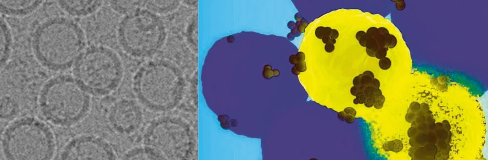 Elektronový mikroskopický snímek nanočástic navržený týmem vedeným výzkumníky z Penn State (vlevo); nanočástice, zobrazené jako černé tečky, nacházejí bazální buňky rakoviny prsu ve žluté barvě a poskytují nástroje pro úpravu genů — rozpadající se buňka demonstruje destruktivní sílu terapie dodávané nanočásticemi (vpravo) © Dipanjan Pan / PSU
