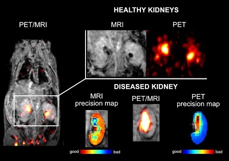 Současné PET/MRI zobrazení zdravých a poškozených myších ledvin pomocí duální kontrastní látky